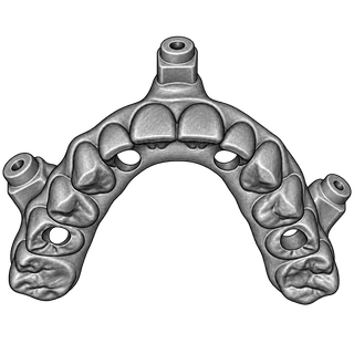 Implantatversorgung